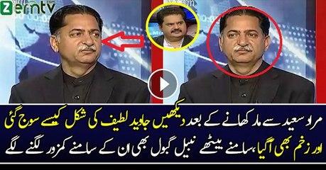 Javed Lateef Ki Muka Khane Ke Baad Shakal Sooj Gaye