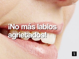 ¡No más labios agrietados!