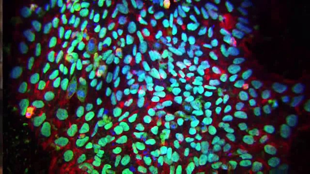 What is Amniotic Stem Cell Therapy