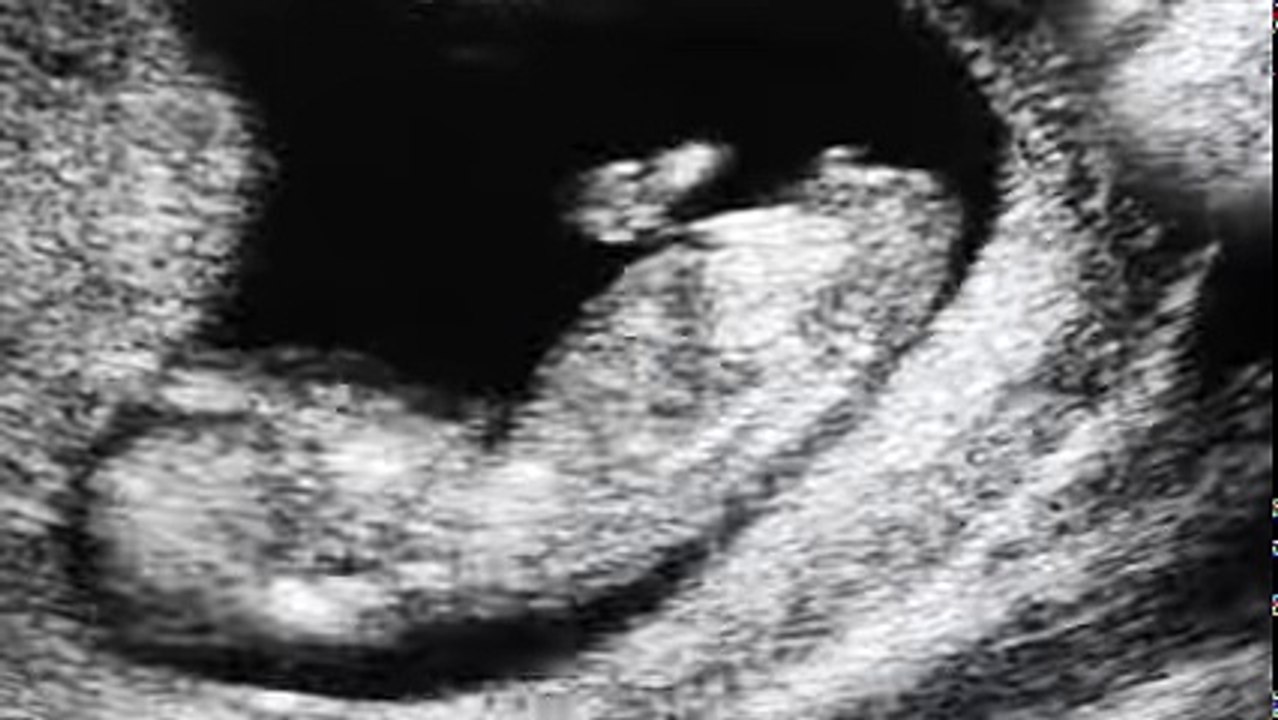 videoplayback_2