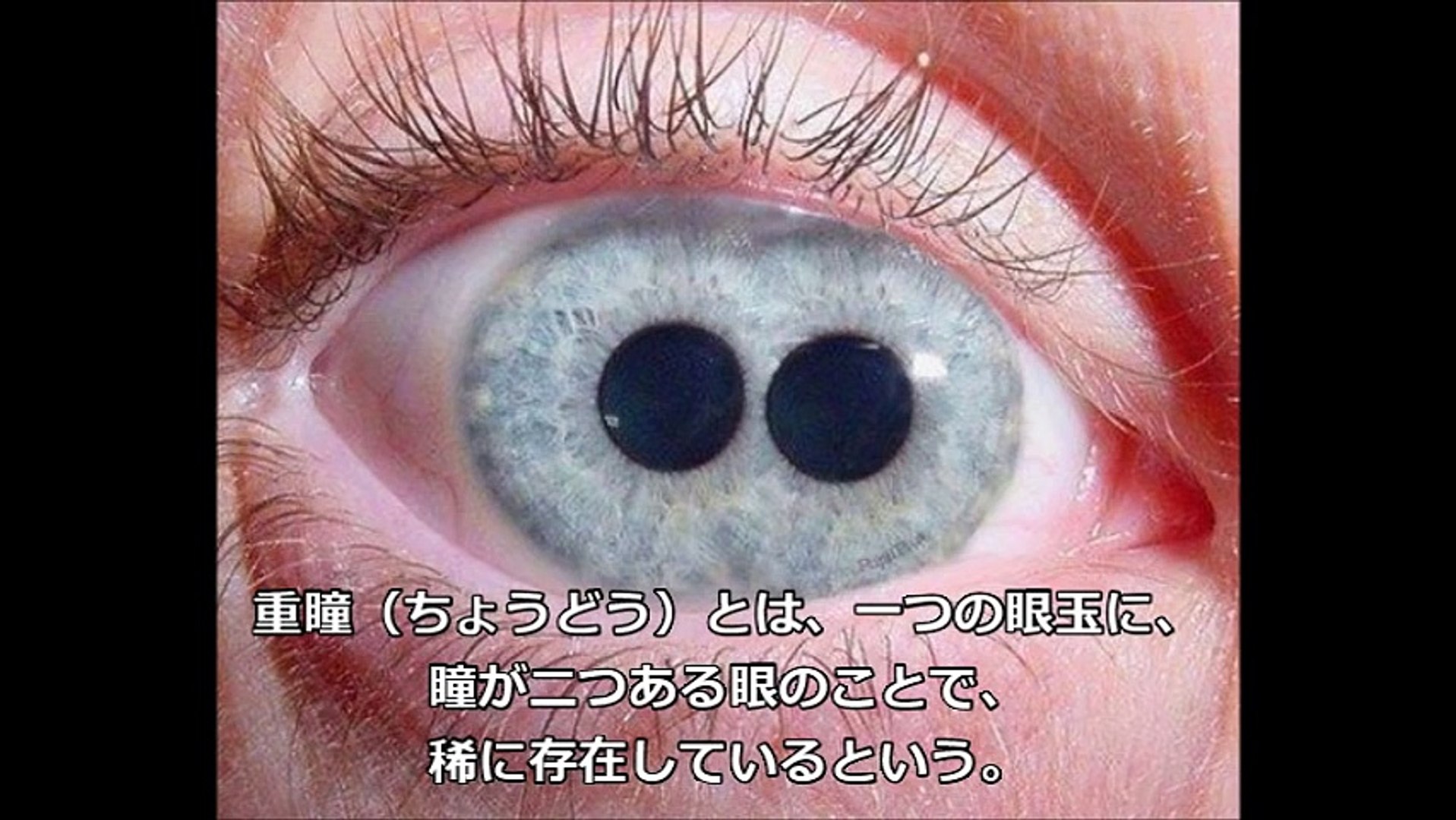 閲覧注意 瞳が2つある 重瞳 ちょうどう の人々が神秘的すぎる Video Dailymotion