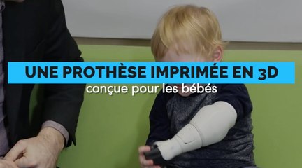 Ce papa a créé une prothèse imprimée en 3D pour son bébé amputé