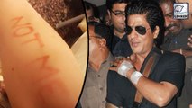 Shah Rukh Khan Undergoes Surgery