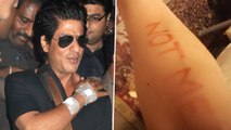Shah Rukh Khan Undergoes Shoulder Surgery