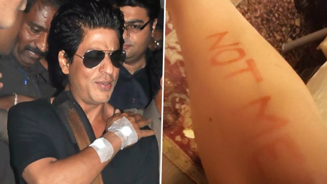 Shah Rukh Khan Undergoes Shoulder Surgery