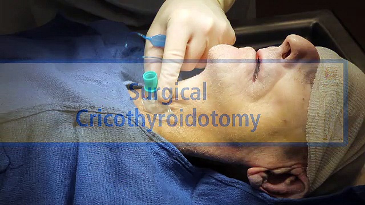 Surgical Cricothyroidotomy