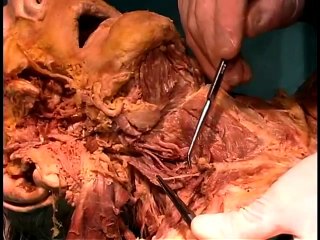 Anatomical dissection #13_ Superficial neck
