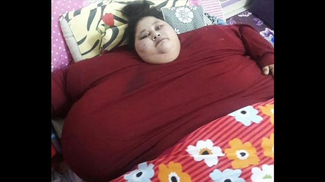 La femme la plus grosse du monde a perdu 100 kilos après une opération chirurgicale associée à un régime