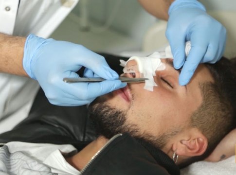 Exclu Public : Eddy a refait son nez et voici la vidéo choc de sa chirurgie esthétique...