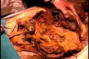 Anatomical dissection #7_ Gastrointestinal tract, abdominal organs & blood supply.