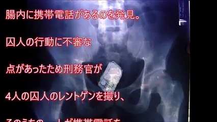 【閲覧注意】レントゲン写真で撮った写真が衝撃すぎると話題に！快楽を追及した結果がヤバイ【驚愕】 ᴴ ᴰ