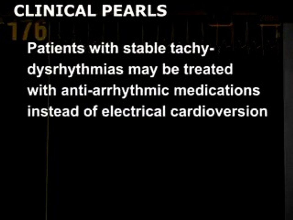Cardioversion