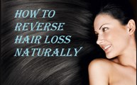 How to Reverse Hair Loss Naturally || Top Secrets for Reversing Hair Loss || Home Remedies