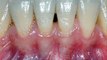 West Frisco Dental And Implants - www.westfriscodental.com - dentist in frisco tx
