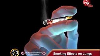 Aarogyamastu _ Smoking Effects on Lungs _ 8th March 2017 _ ఆరోగ్యమస్�