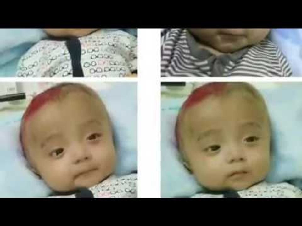 Hành Trình Rớt nước mắt hình ảnh cậu bé bị não úng thủy Đức Lộc bị bỏ rơi khi mới lọt lòng