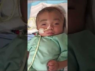 Hơi thở thoi thóp của em bé mắc bệnh não úng thuỷ bị bỏ rơi trước cổng chùa