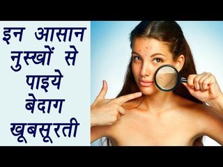 How to get clear Skin with Home Remedies | आसान नुस्खों से पाइये बेदाग़ खूबसूरती | Boldsky