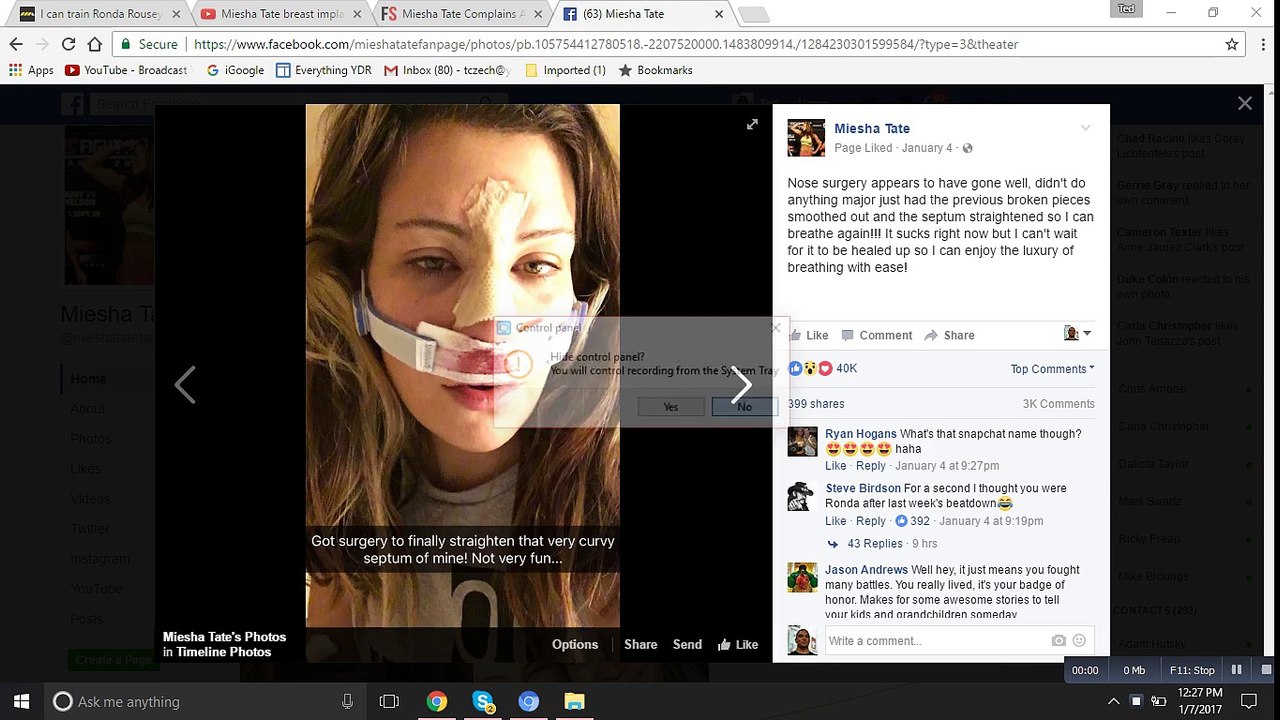 Miesha Tate gets nose job is Hollywood calling?