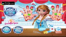 Anna Hand Doctor - Disney Princess Anna Game for Kids - Frozen Games