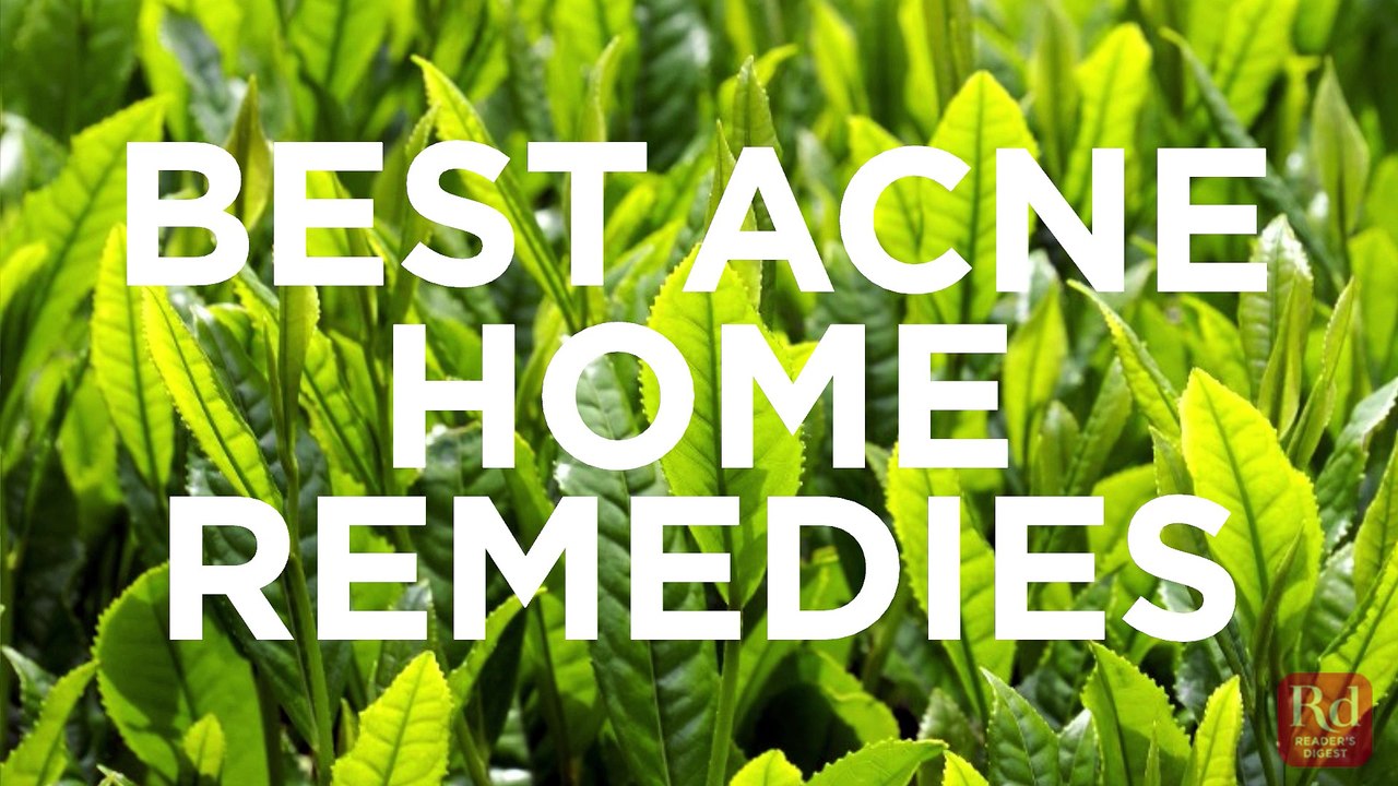 best acne home remedies