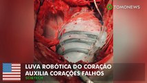 Luva robótica do coração auxilia corações falhos.