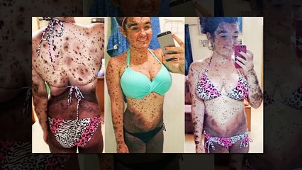 ඔබේ නෙත් කඳුලෙන් තෙත් කරන තරුණ ජීවිත 5ක් - Teens you won't believe actually exist