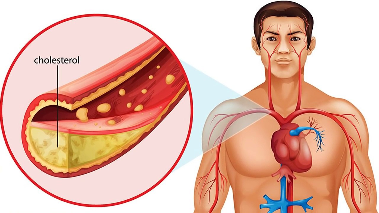 කඩල කනවිට ඔබේ ශරීරයට සිදුවෙන දේ මෙන්න - What happens when you eat chickpeas