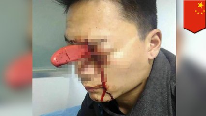 Man stabbed in eye with knife calmly waits to see the doctor