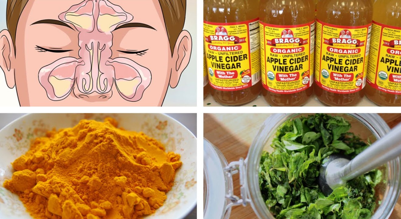 Best Natural Home Remedies for Sinusitis