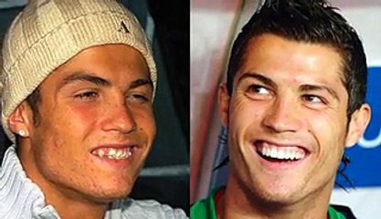 Known before and after correction of teeth