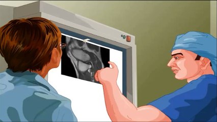 Arthrography - MEDICAL DEFINITIONS