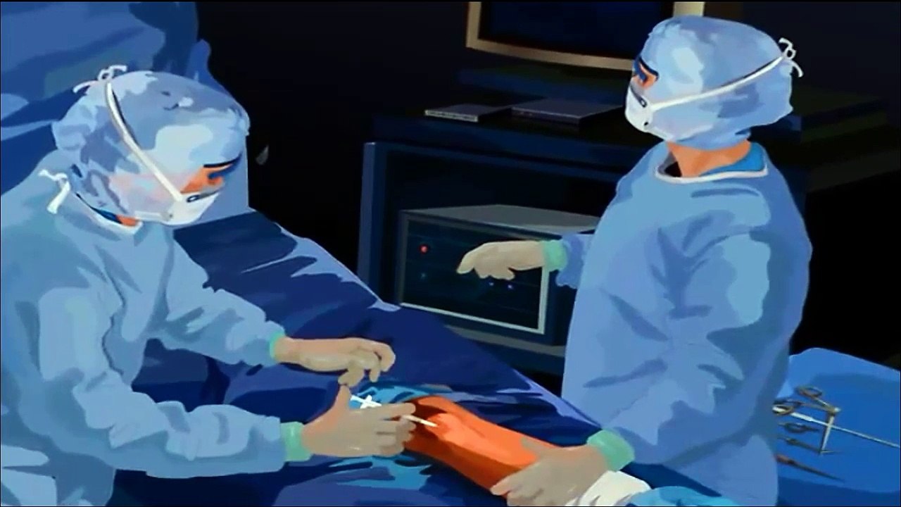 Arthroscopic debridement