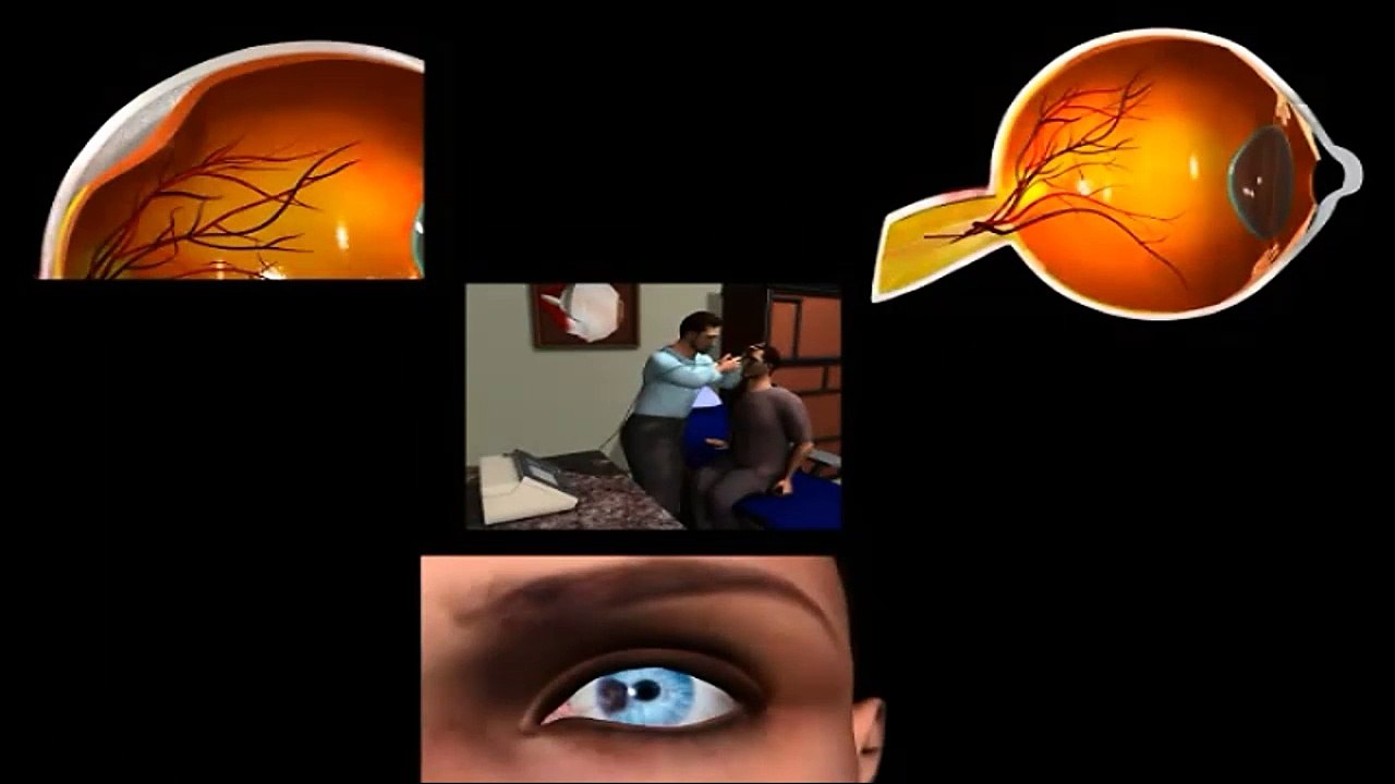 A-scan - MEDICAL DEFINITIONS