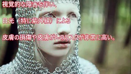 【驚愕】世界の美しく神秘的と言われる奇病・難病『アルビノ』美しすぎるロシア出身モデル アルビノの少女、ナスチャ・クマロヴァ（先天性白皮症）【驚愕】妖精の顔