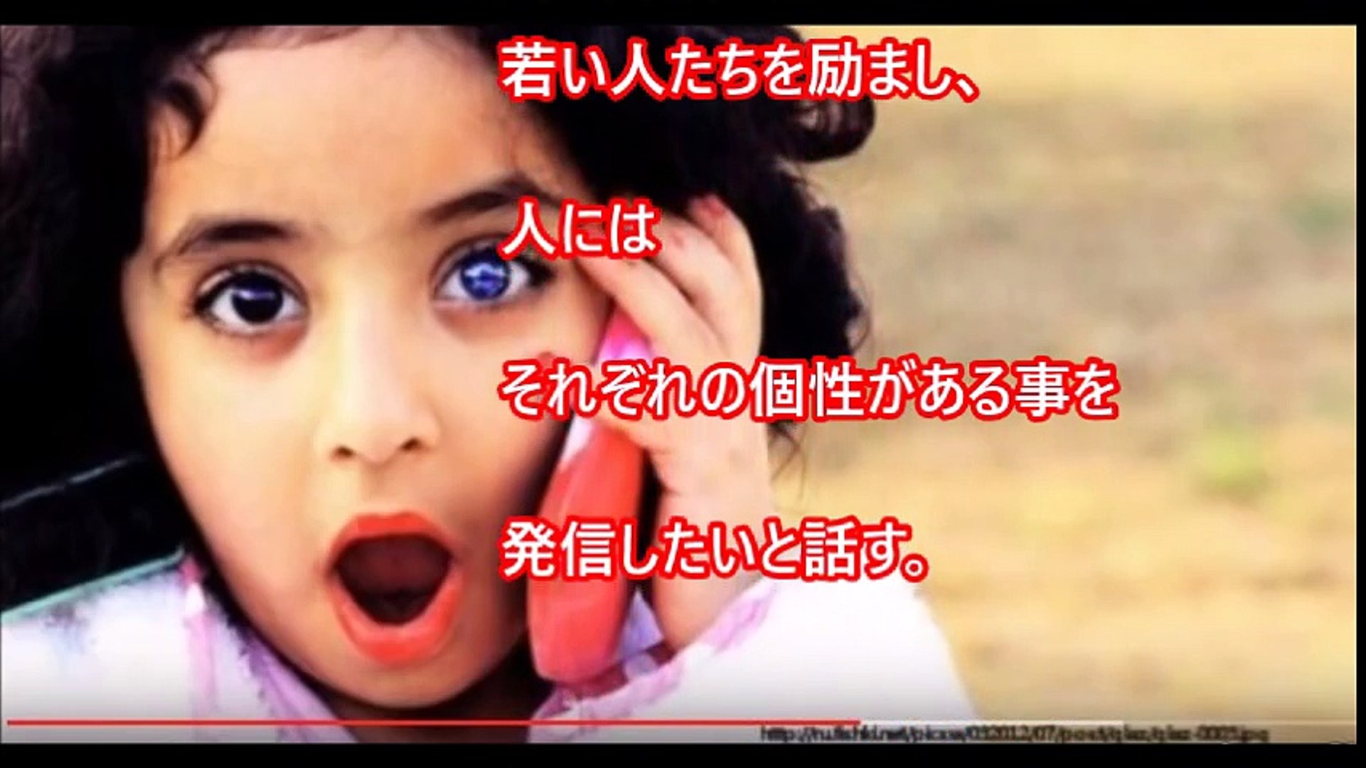 閲覧注意 妖精の顔 で生まれる奇病 世界が震えたワールデンブルグ症候群 嘘のような本当の驚くべき奇病がヤバすぎる Video Dailymotion