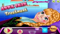 ANNA HAIR CARE DOCTOR! Disney Princess Games - Frozen Games - Kids Games HD