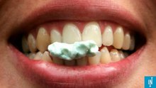 Santé ! Que risque-t-on quand on avale un chewing-gum