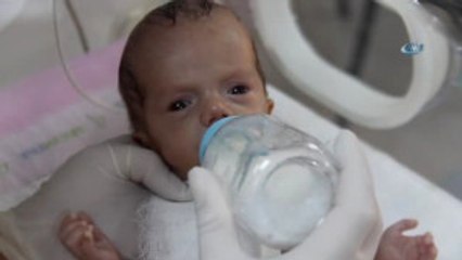 Miras Anne Sütüyle, Yaşam Savaşını Kazandı