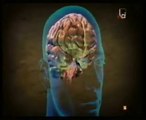Esquizofrenia: Muerte por delirio agitado (Autopsia forense)