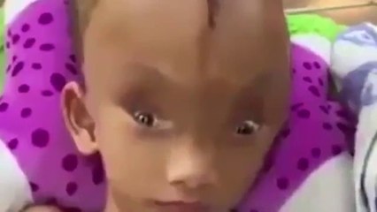 La maladie rare de ce garçon est impressionnante