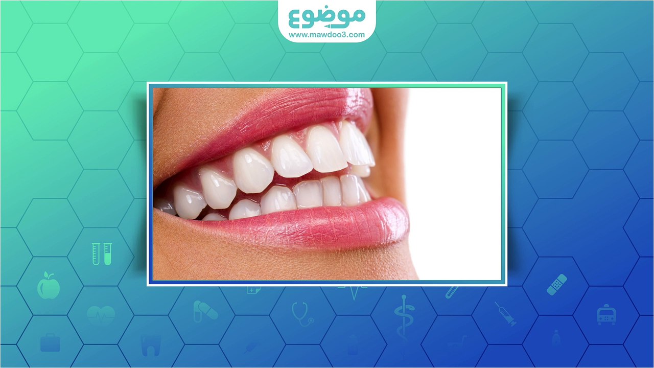 #موضوع: ما هو #التهاب_اللثة وأعراضه