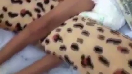 Ce petit garçon souffre d'une maladie rare