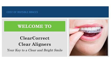 Get Top Quality Clear Aligners in Sydney