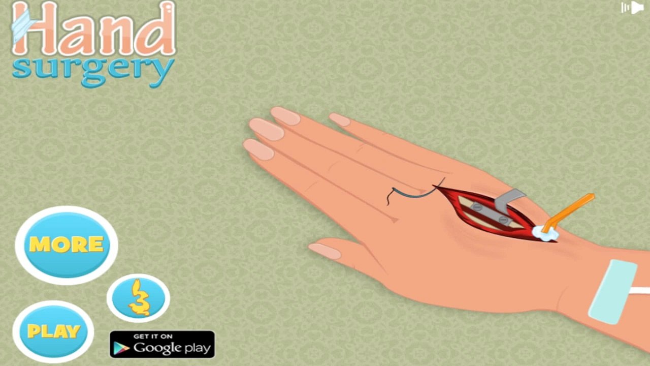 Детка ребенок перелом Игры рука орешник играть Кому Это Yourchannelkids