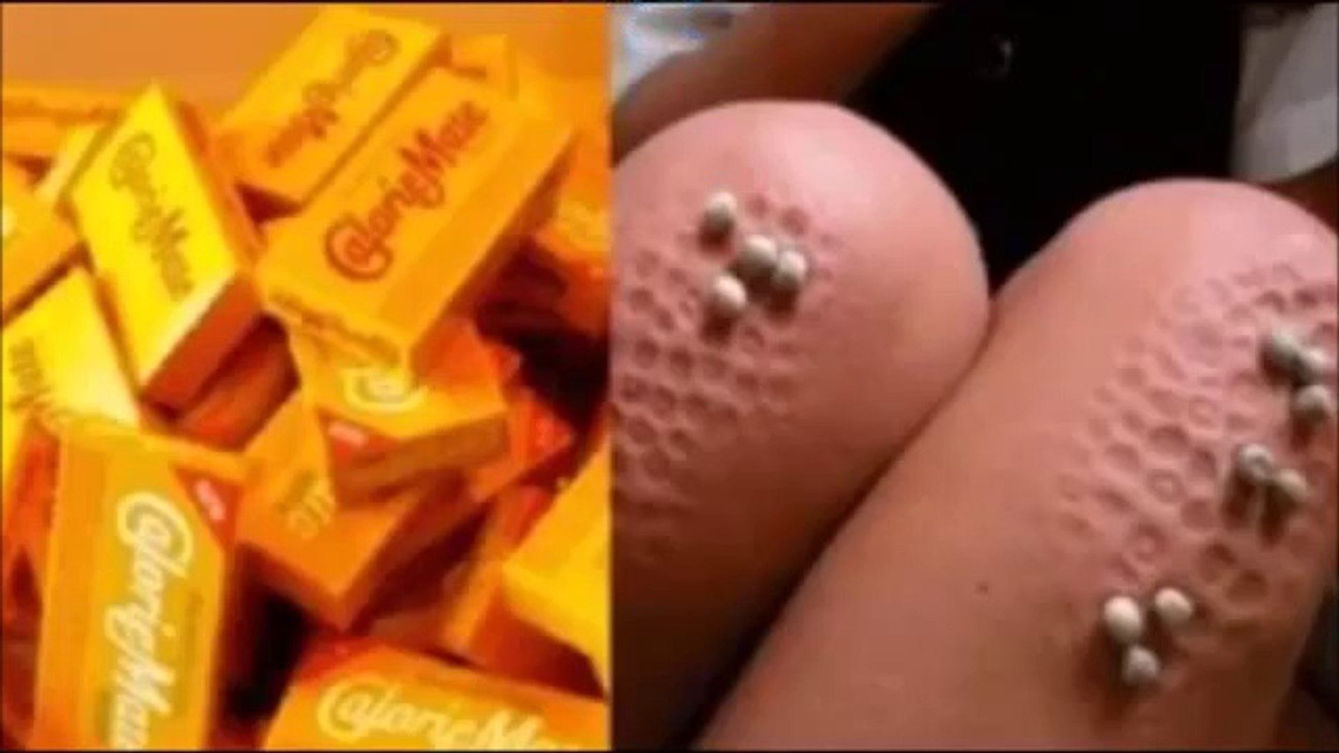 知らなきゃヤバい カロリーメイトを４か月食べ続けた結果 悲惨すぎる衝撃事実 知って得 嘘のような本当 Video Dailymotion