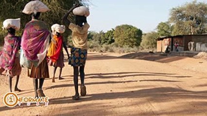 Así luce el niño más negro del mundo, 4 años después. Mira porqué sus papás lo esconden