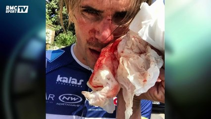 Yoann Offredo : ''Les qéquelles physiques représentent peu par rapport aux séquelles morales''