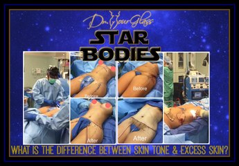 What is the difference between skin tone and excess skin