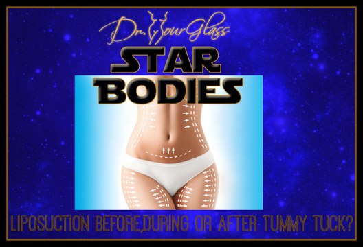 Liposuction before, during, or after a tummy tuck